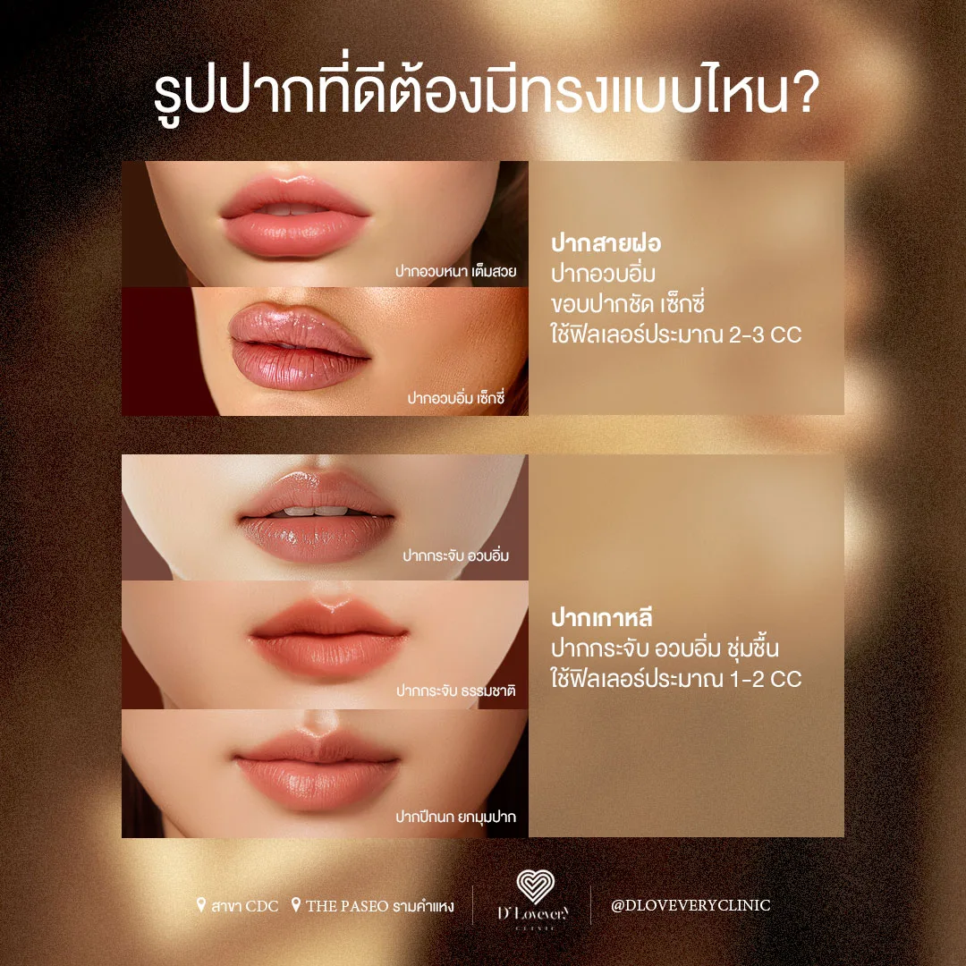 ฟิลเลอร์ปาก มีกี่ทรง แบบไหนดี ใช้กี่ cc