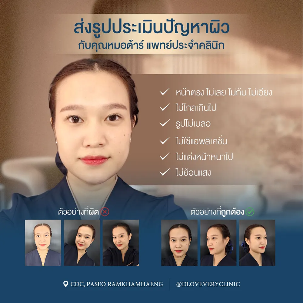 ส่งภาพประเมินปัญหาผิวหน้ากับแพทย์