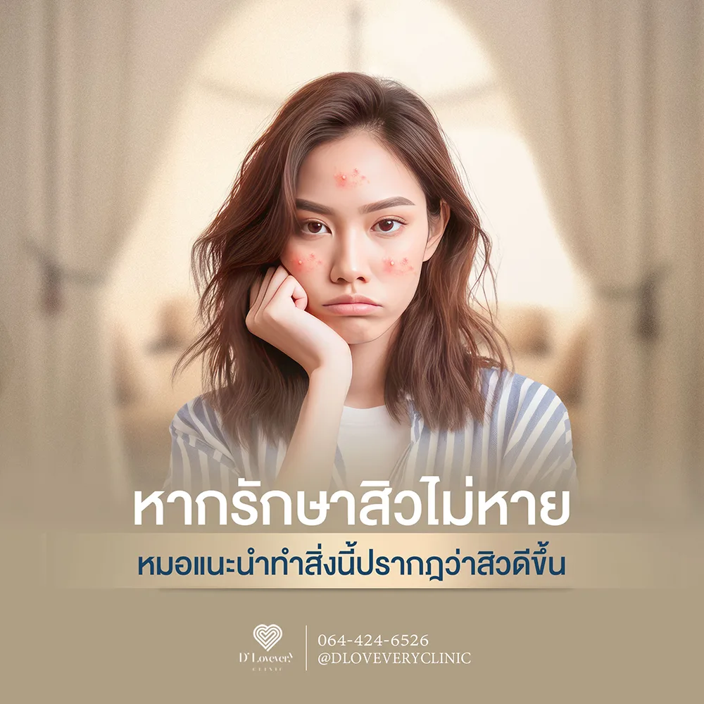 หากรักษาสิวไม่หาย หมอแนะนำทำสิ่งนี้ปรากฎว่าสิวดีขึ้น