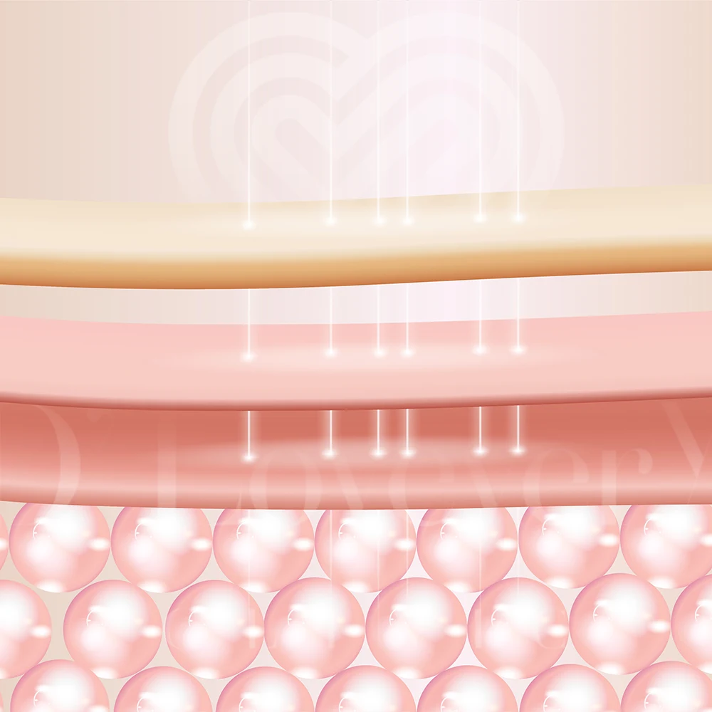 Ulthera non-surgical SMAS skin lift cross-section illustrating focused ultrasound penetration