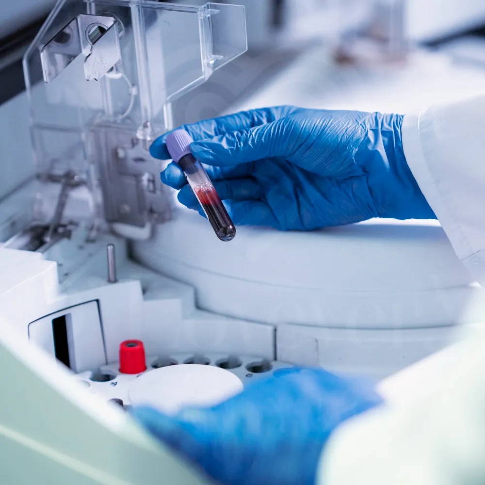 Lavender-capped blood test sample held by gloved technician above clinical analyzer rotor