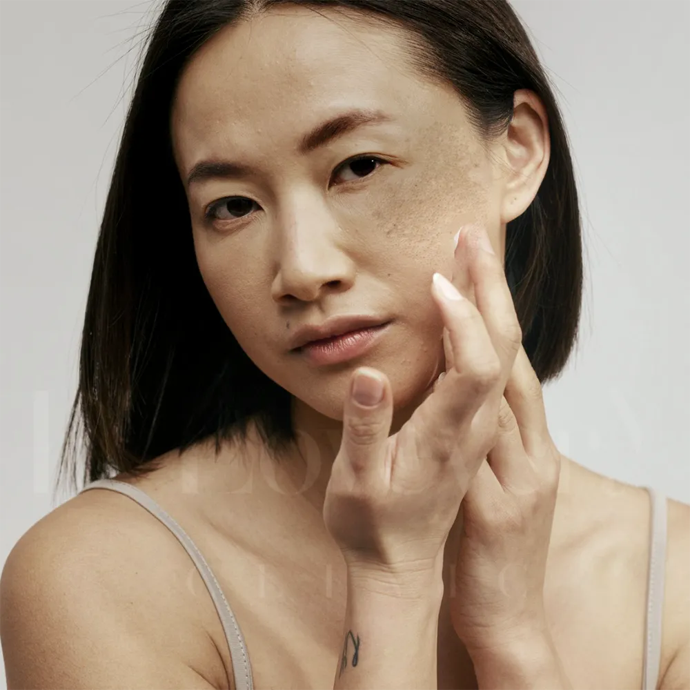 Woman with cheek melasma touching face, natural skincare treatment portrait