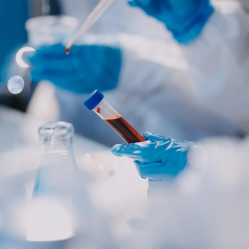 Gloved hands pipetting blood into capped test tube for hormone testing