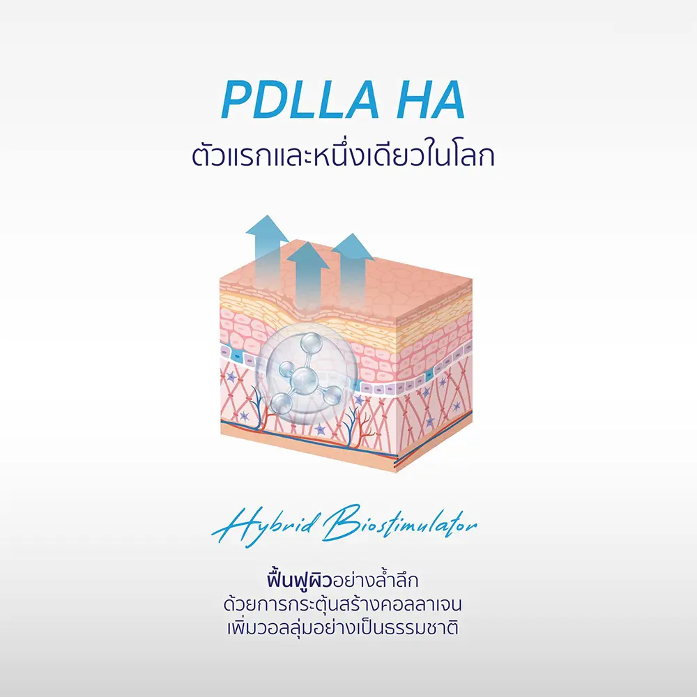 PDLLA HA hybrid biostimulator skin lift diagram with microspheres beneath dermis, upward arrows