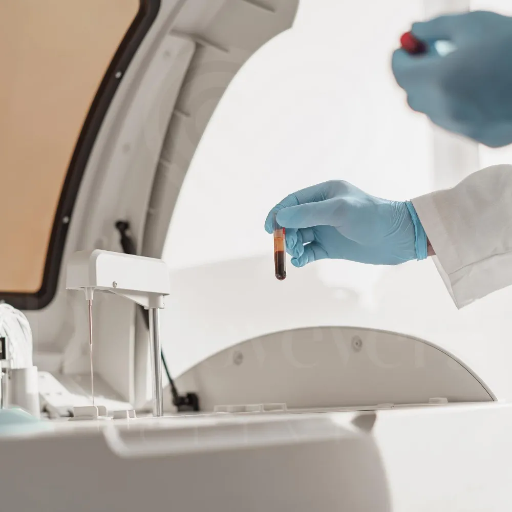 Gloved hand holding vitamin blood test tube near clinical analyzer in sterile laboratory