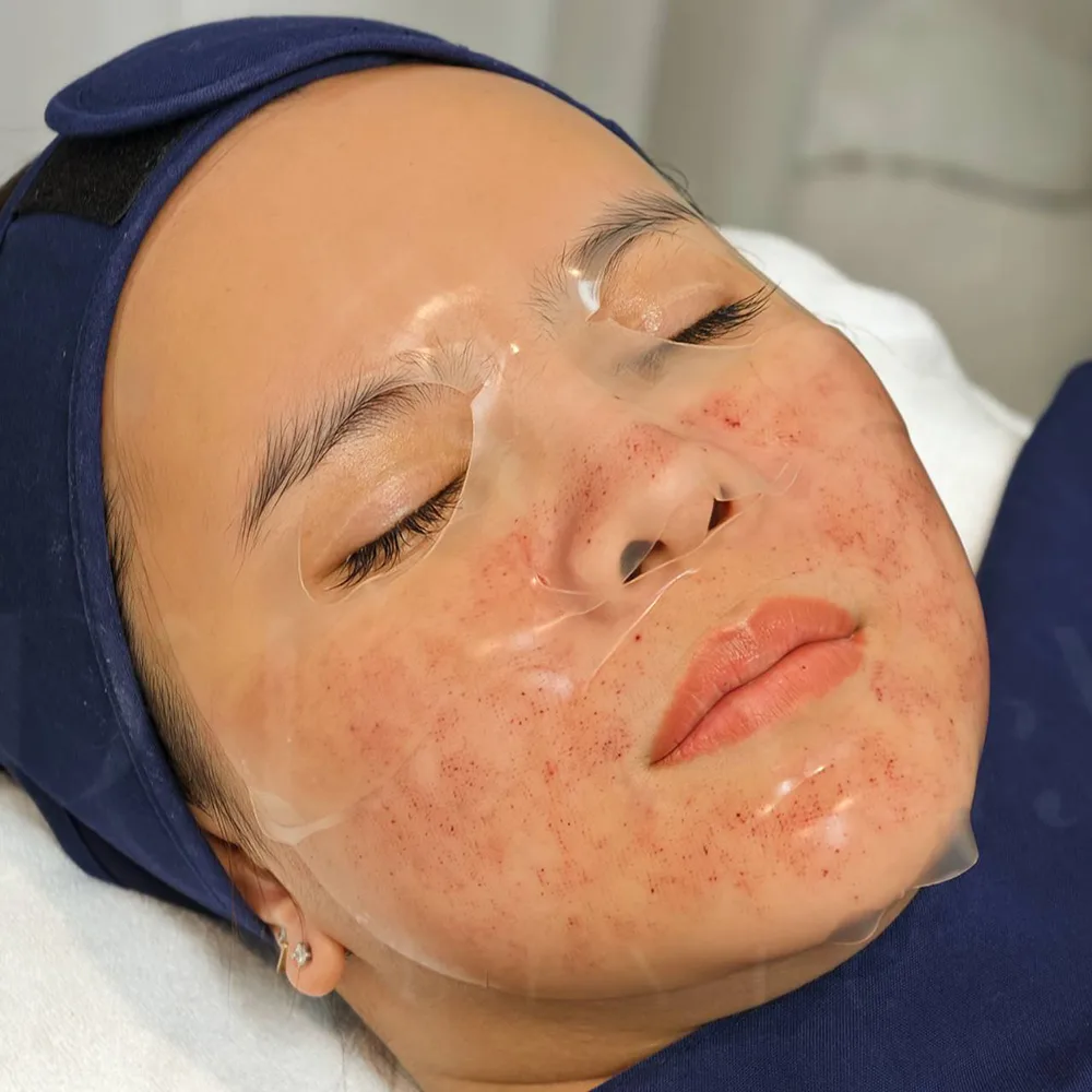 Pico laser aftercare patient with soothing redness gel mask and navy headband
