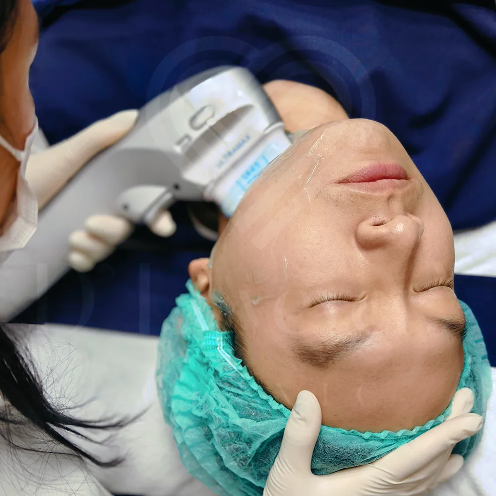 HIFU jawline lift for men, non-surgical contouring with handheld applicator