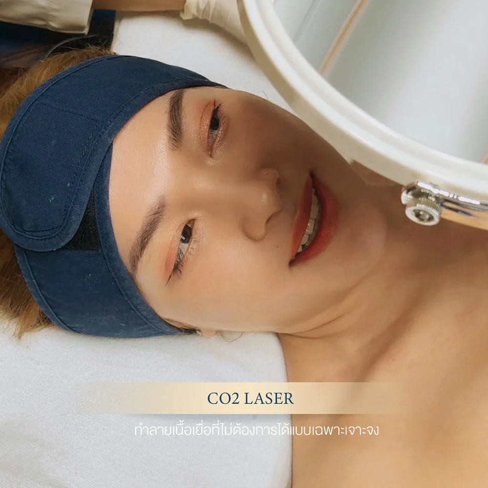 Patient inspecting CO2 laser mole removal results in clinic mirror