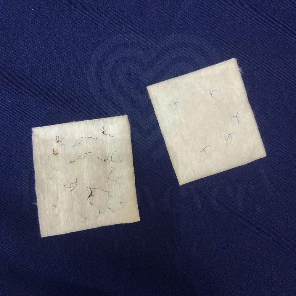 Lint-covered cotton pads with hairs and blue threads on navy fabric