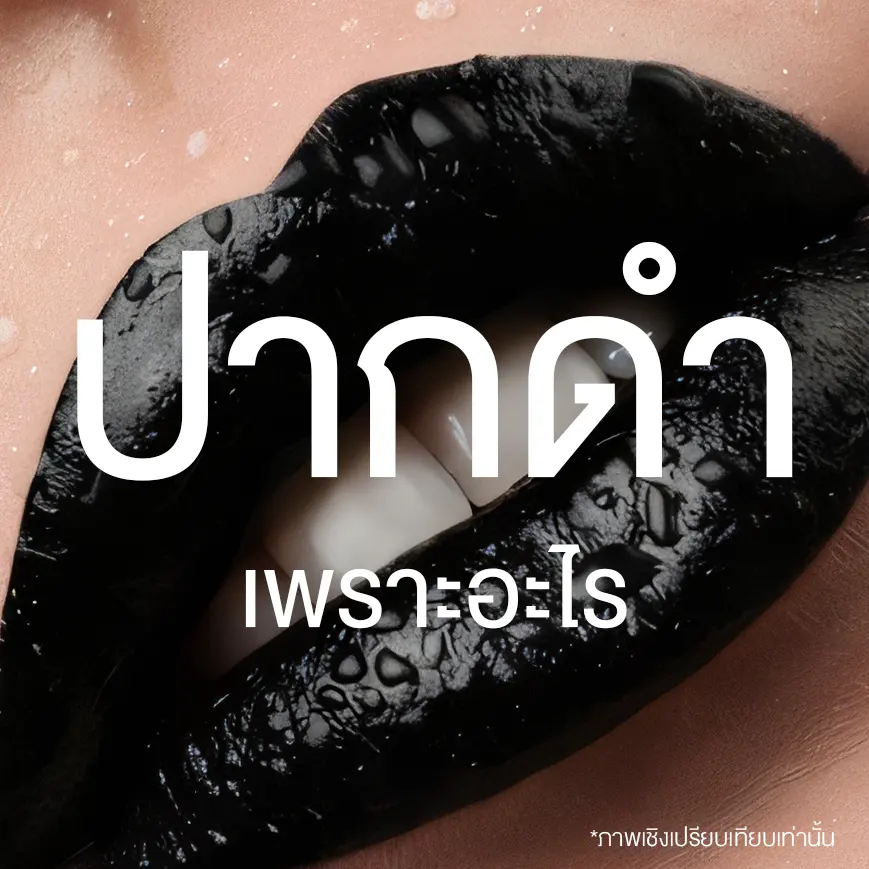 Glossy black lips close-up with Thai why text — dark lips causes and treatments