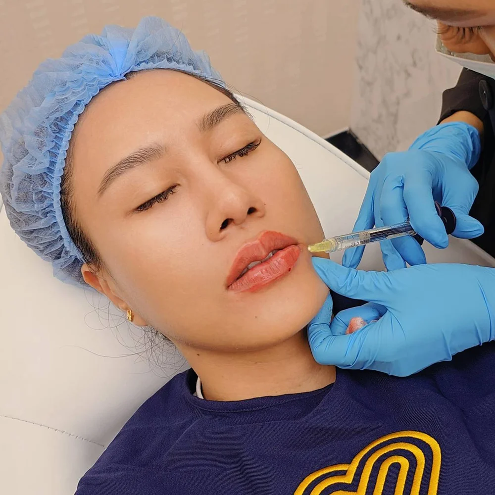 Cosmetic lip filler injection close-up in clinic, patient reclined, gloved hands with syringe.