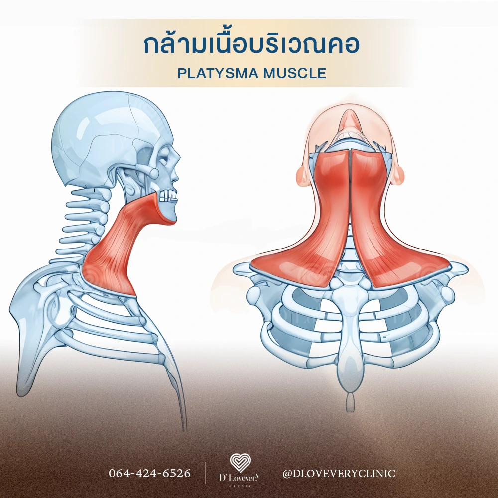 กล้ามเนื้อคอด้านใน โบท็อกซ์คอ