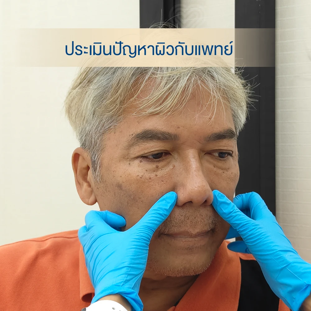 ดูแลจบที่เดียว! ฟิลเลอร์ร่องแก้ม เติมเต็ม กระเนื้อจุดเล็ก ๆ ไม่รบกวนใจ