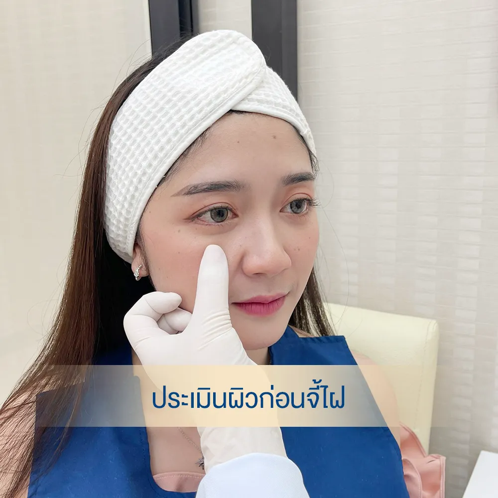 Dermatologist assessing under-eye mole before removal during facial skin assessment