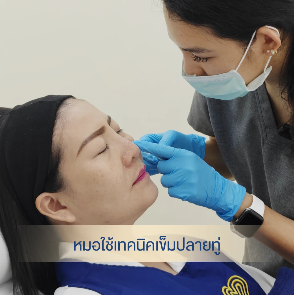 Safe under-eye filler procedure with blunt-tip needle by masked practitioner in cosmetic clinic