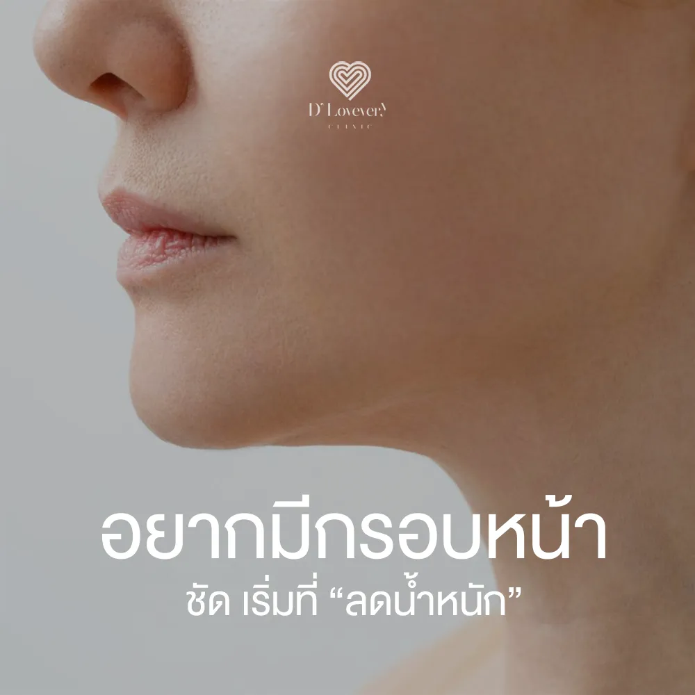 Close-up profile of sculpted jawline promoting facial slimming and weight loss