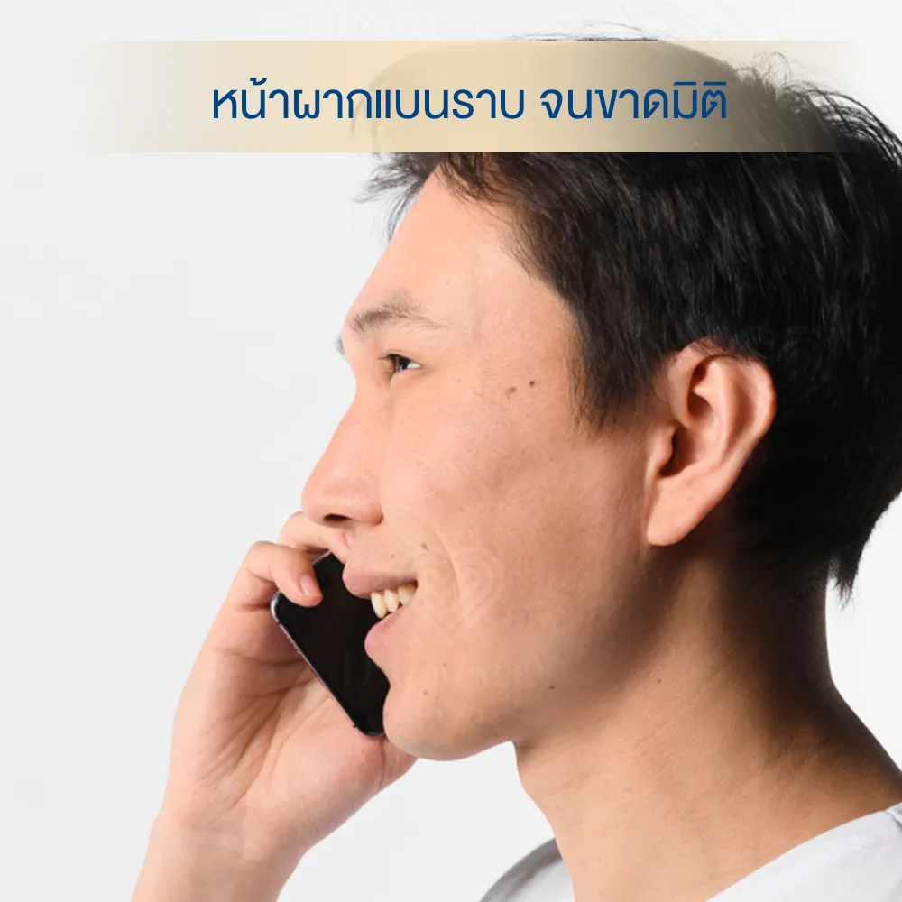 หน้าผากแบน ทำยังไงดี dlovevery clinic