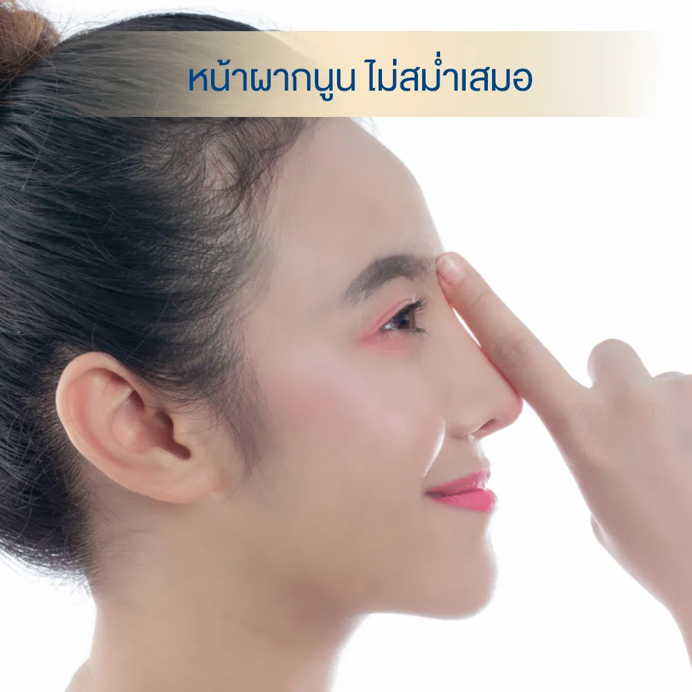 หน้าผากเป็นคลื่น นูน ไม่สม่ำเสมอ ทำยังไงดี dlovevery clinic