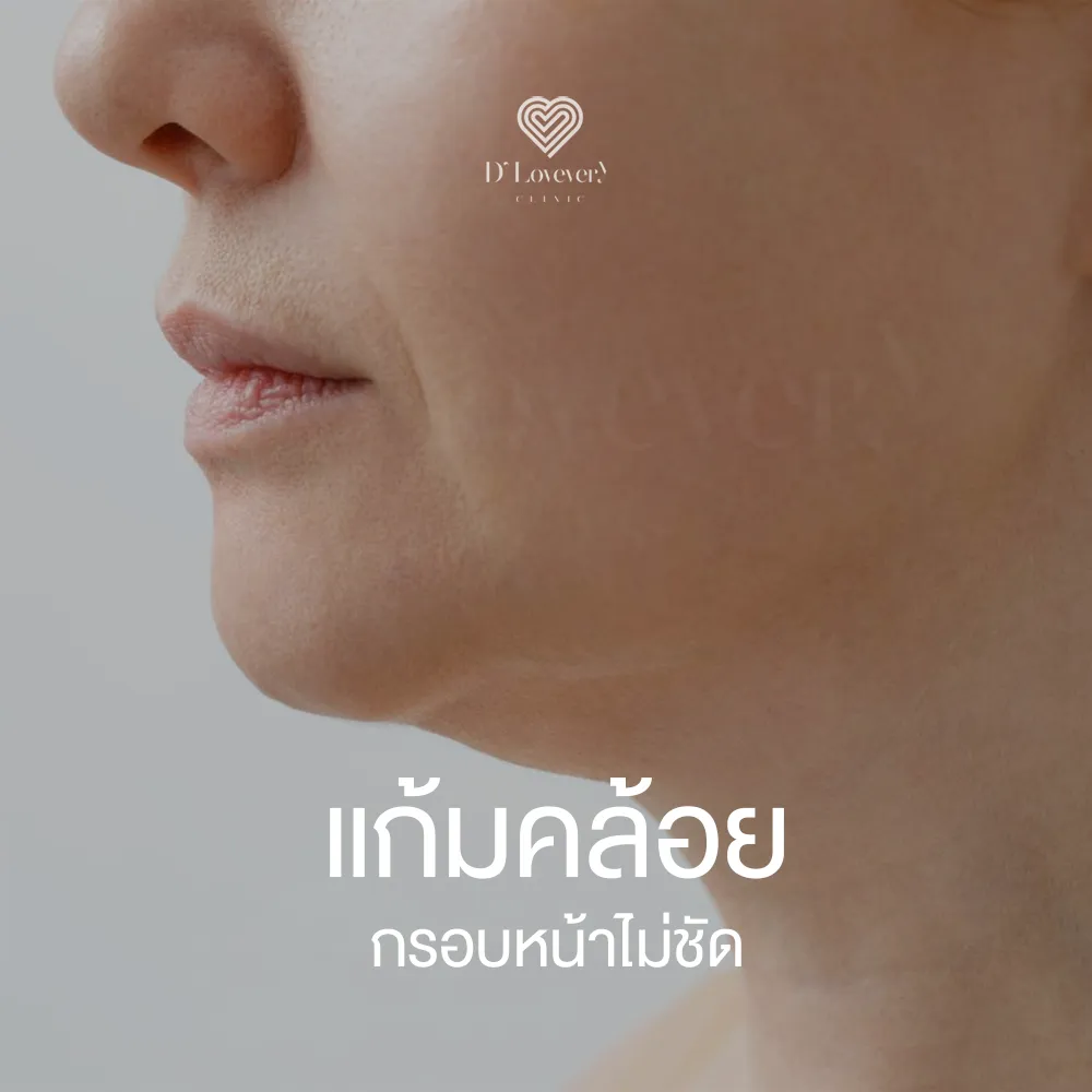 Close-up profile showing sagging cheeks and undefined jawline, aesthetic clinic promotional image