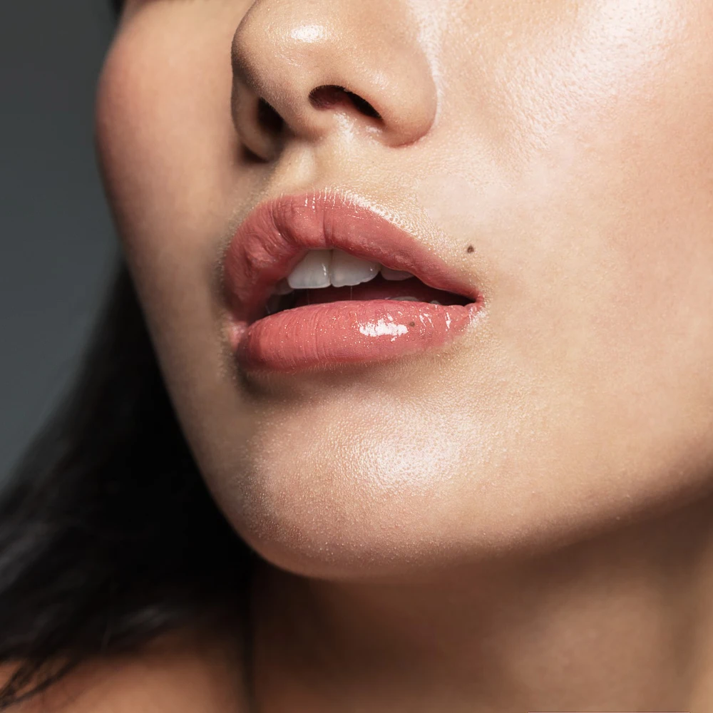 Close-up of mole above upper lip with glossy lips — laser mole removal safety