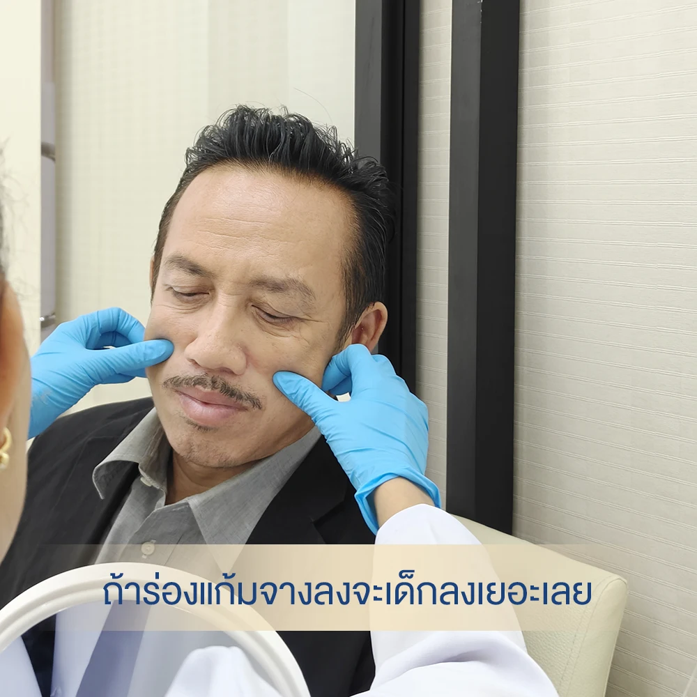 หมอต้าร์แนะนำ ฟิลเลอร์ร่องแก้มสำหรับผู้ชายอย่างปลอดภัย