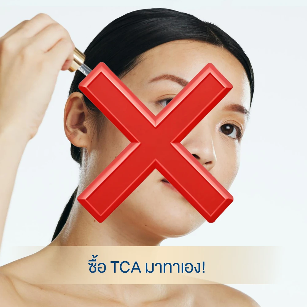Warning: Dont DIY TCA chemical peel — professional treatment recommended.