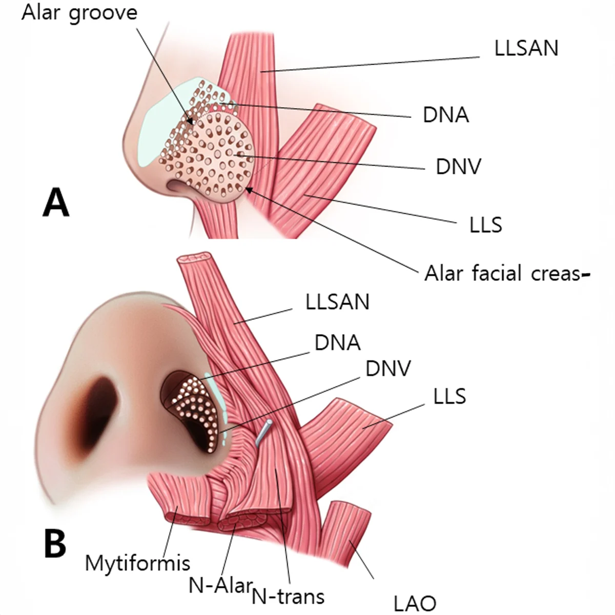 Nasal alar anatomy diagram: muscles, nerves, cartilage, alar creases