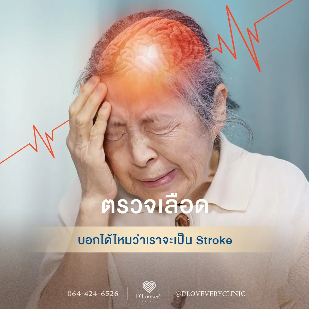การตรวจเลือดสามารถทำนายความเสี่ยงโรคหลอดเลือดสมองของคุณได้หรือไม่?