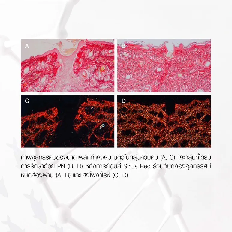 Sirius Red micrographs show PN treatment increases collagen density and fiber organization.
