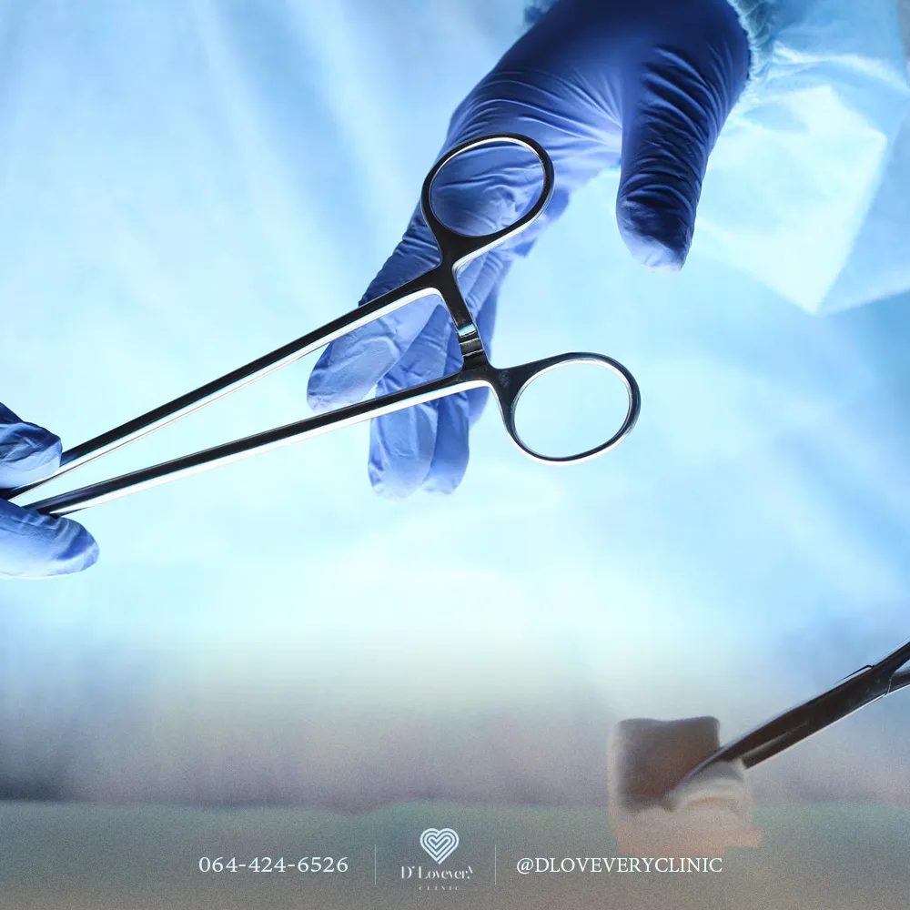 Gloved hands exchanging surgical forceps during silicone removal procedure in clinic