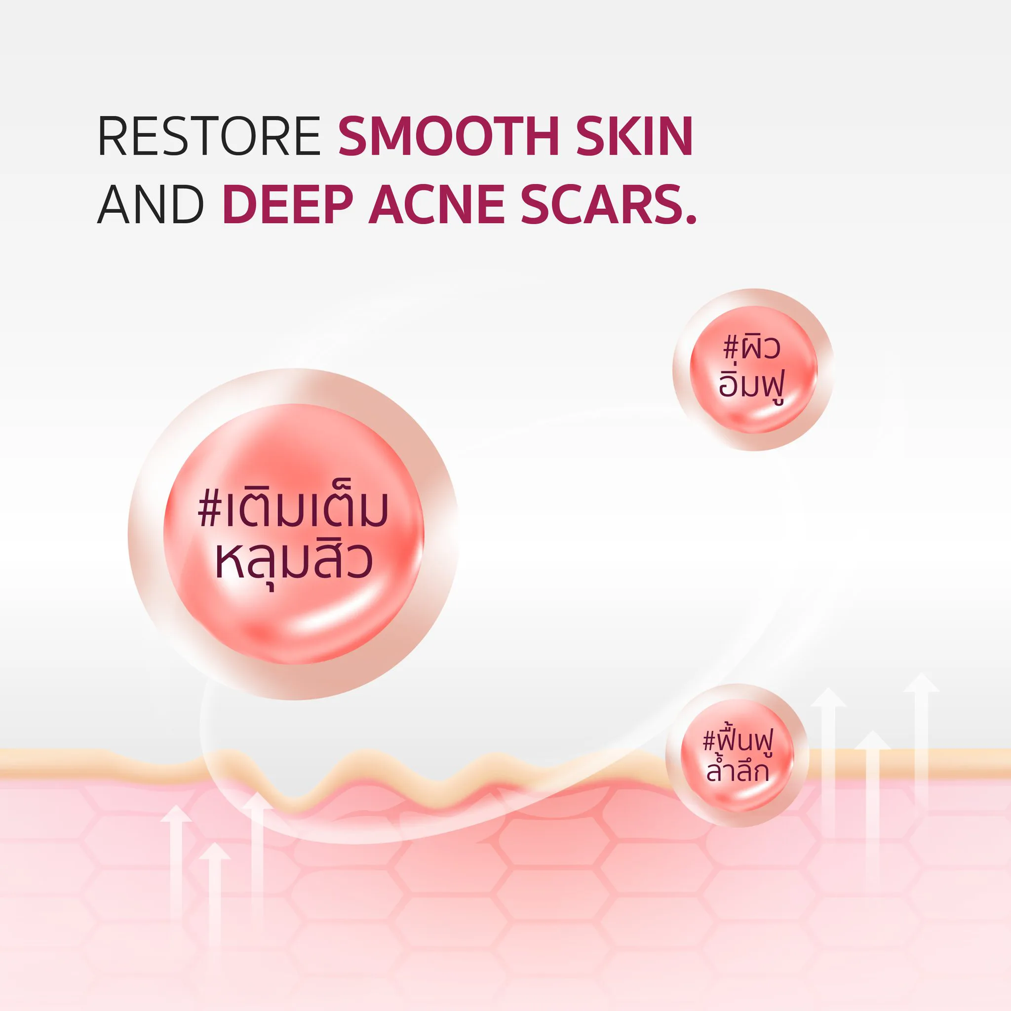 How much does Juvelook filler for acne scars cost?