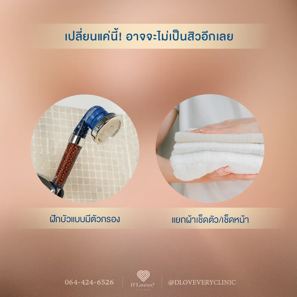 เป็นสิวไม่รู้สาเหตุ? บางทีคำตอบอาจไม่ได้อยู่ที่คลินิกเสมอไปค่ะ ลองเปลี่ยนแปลงสิ่งนี้ดูก่อน
