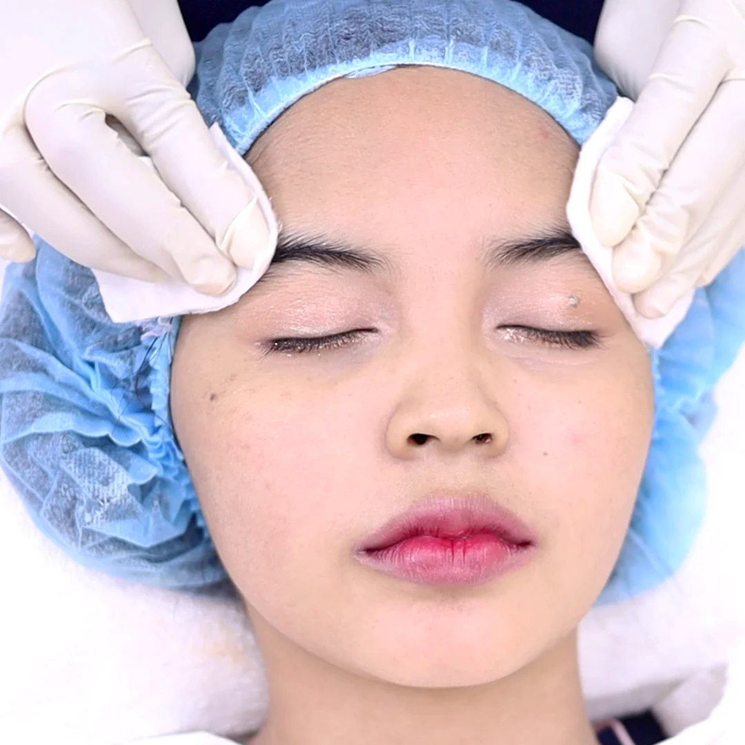 ผิวแข็งแรงขึ้นจริงไหม พิสูจน์ผลลัพธ์ D' Facial หลังทำต่อเนื่อง 1 เดือน