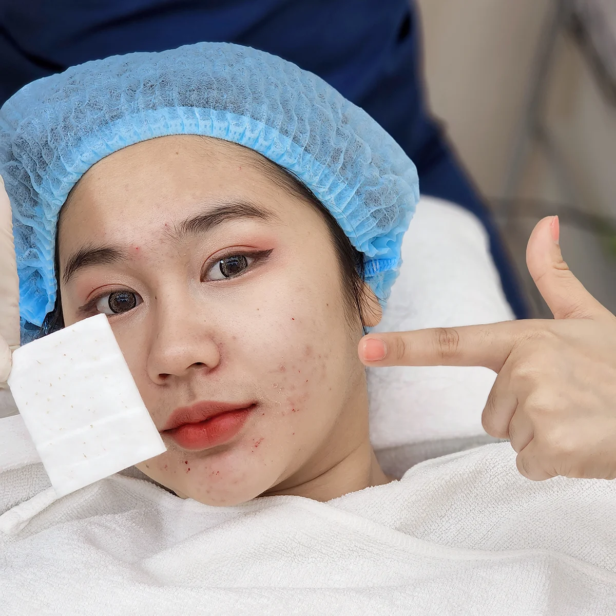 [รีวิวรักษาสิว] สิวฮอร์โมน หรือ สิวแพ้แมสก์? เคลียร์จบทุกปัญหา เห็นผลดีไม่มีเลี้ยงไข้ เพราะหมออยากให้ทุกคนหาย