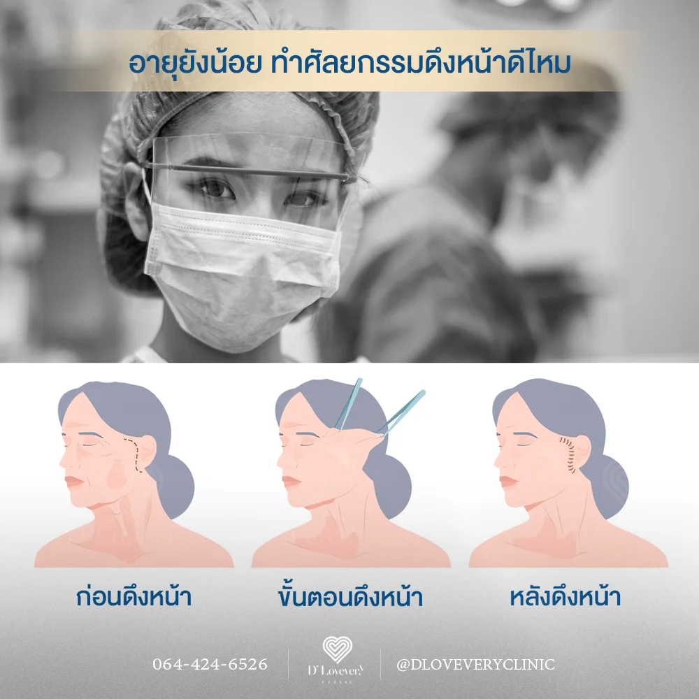 หน้าหย่อนคล้อยแค่ไหนถึงต้อง "ดึงหน้า"? หมอศัลยกรรมไขข้อสงสัย พร้อมวิธีเช็ก! ก่อนตัดสินใจทำศัลยกรรมยกกระชับใบหน้า