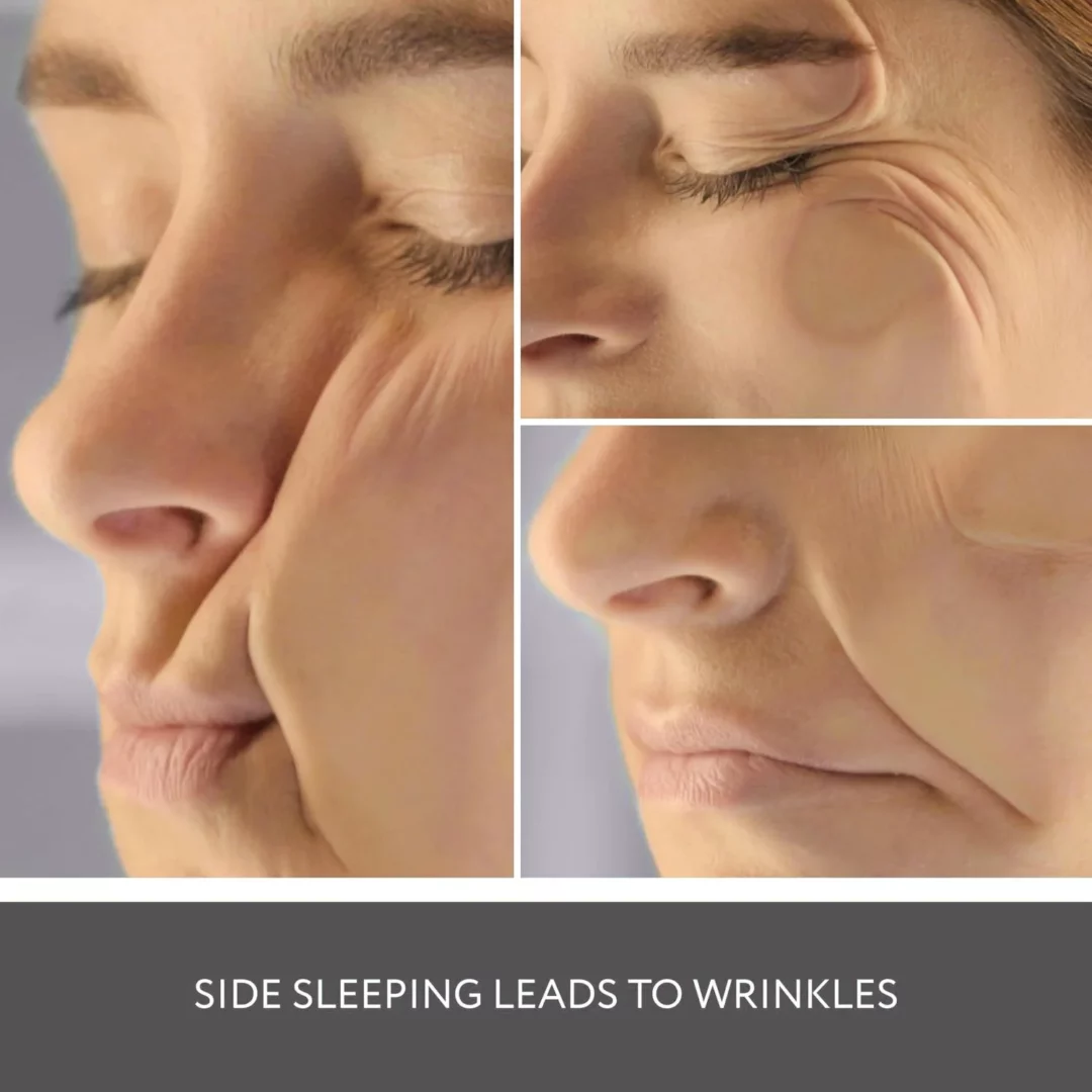 sleep wrinkles