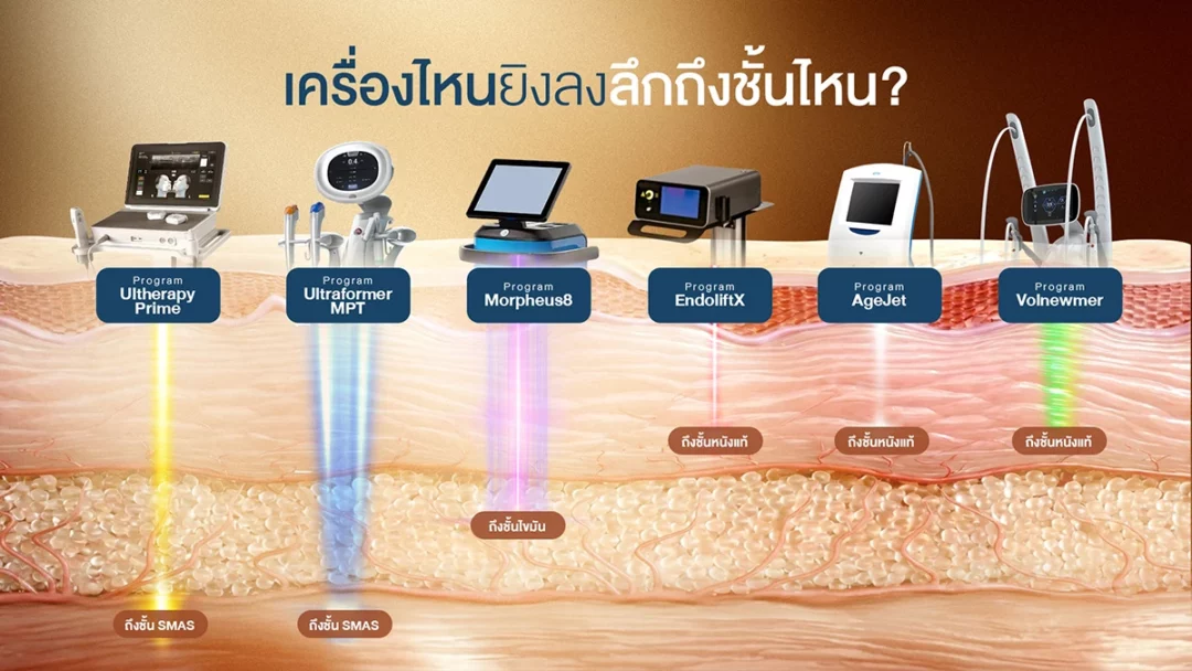 เปรียบเทียบ ulthera กับเครื่องพลังงานอื่นๆ ใครลงลึกระดับไหนบ้าง