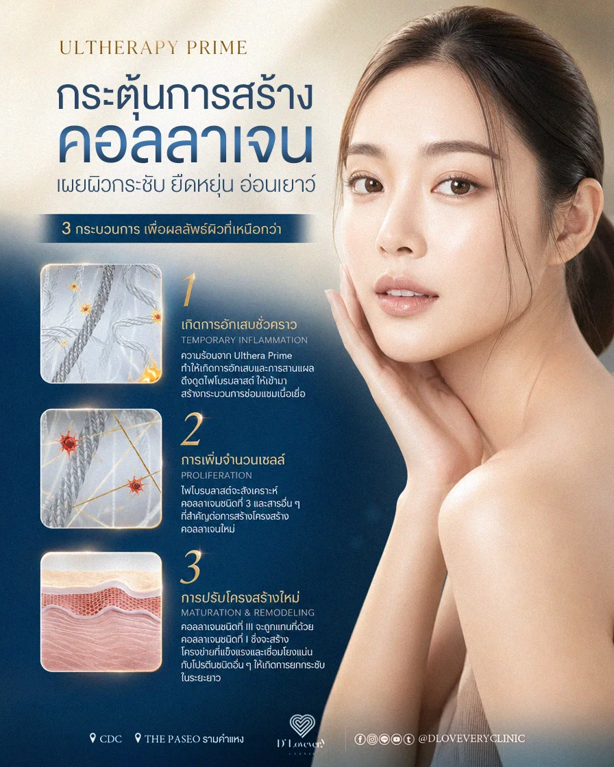 Ulthera Prime ขั้นตอนการทำงาน เพื่อผิวยกกระชับนาน 1 ปี