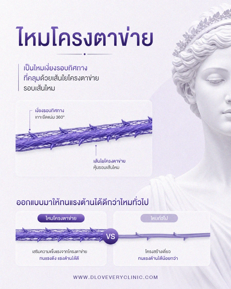 ไหมโครงตาข่าย คืออะไร หน้าตาเป็นแบบไหน ดียังไง ราคาเท่าไหร่