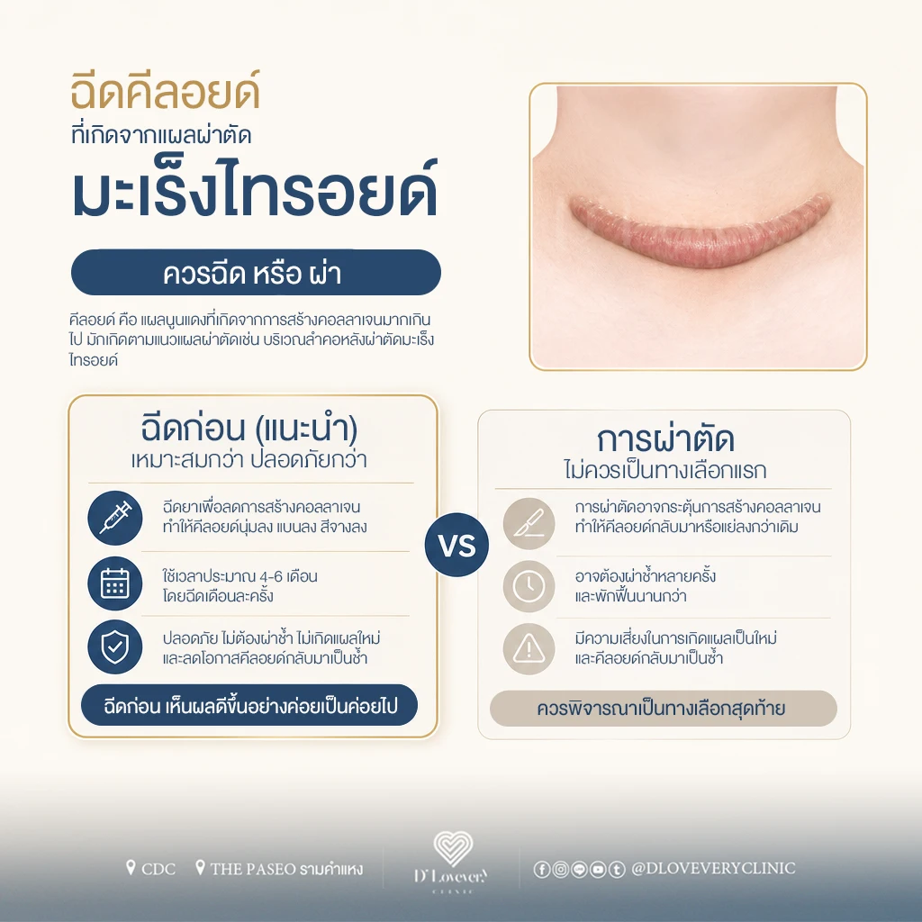 คีลอยด์แผลผ่าตัดไทรอยด์เลือกผ่าหรือฉีดดี? หมอสรุปข้อดีข้อเสีย อัตราการเกิดซ้ำ และวิธีรักษาแผลเป็นนูนที่คอให้เรียบเนียนปลอดภัย ไม่เสี่ยงแผลปูดซ้ำ